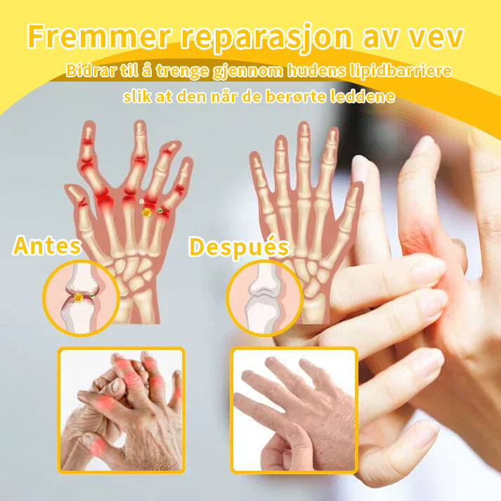 Ropceer™ Toxina Botulínica & Veneno de Abeja Alivio del Dolor Crema Cicatrizante de Huesos