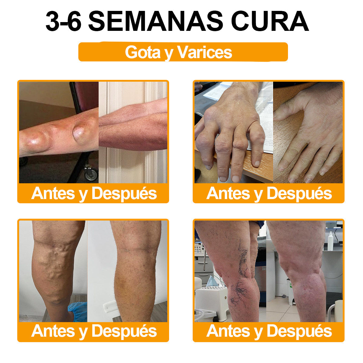 Ropceer™ Toxina Botulínica & Veneno de Abeja Alivio del Dolor Crema Cicatrizante de Huesos