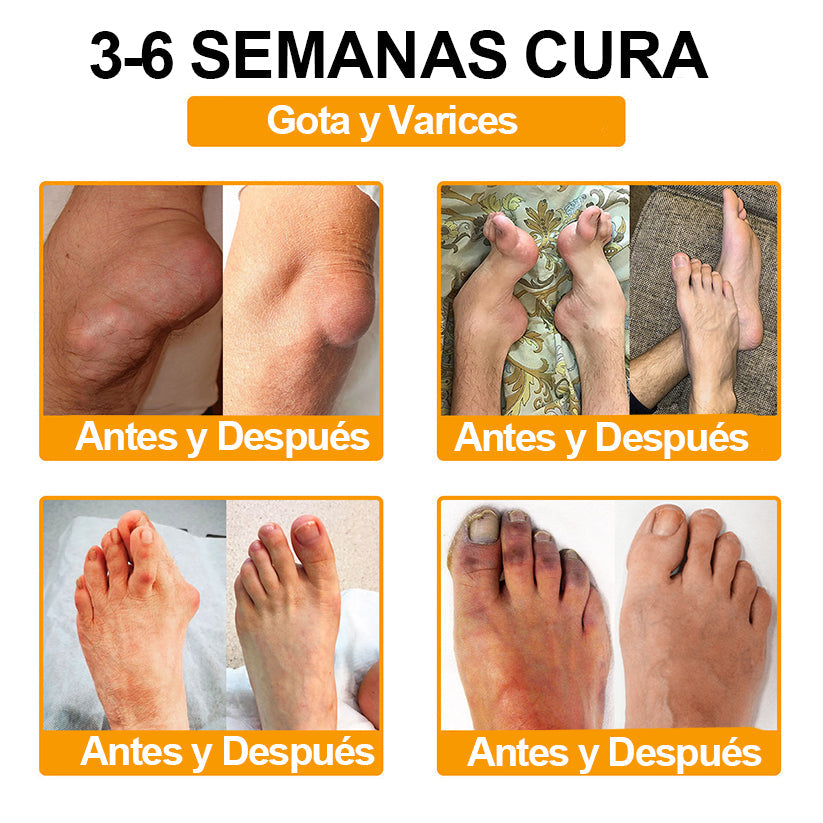 Ropceer™ Toxina Botulínica & Veneno de Abeja Alivio del Dolor Crema Cicatrizante de Huesos